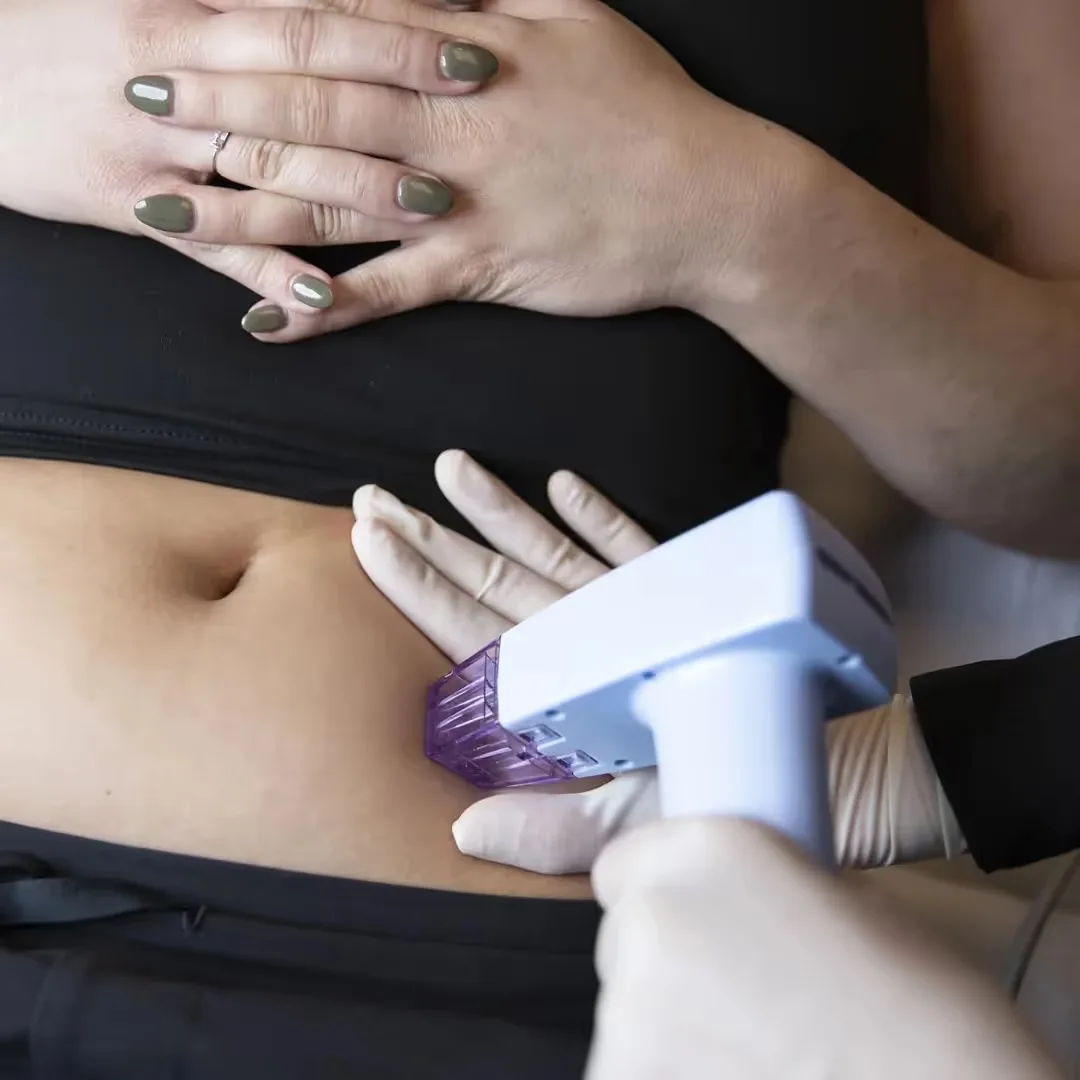 Fat loss treatment consultation