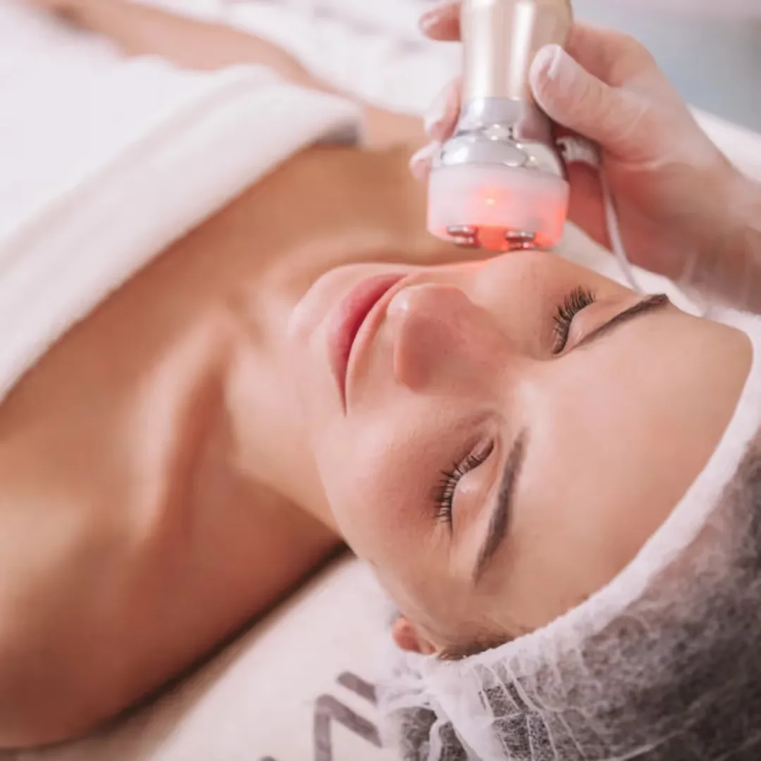 Forma RF Skin Tightening performed by a dermatologist