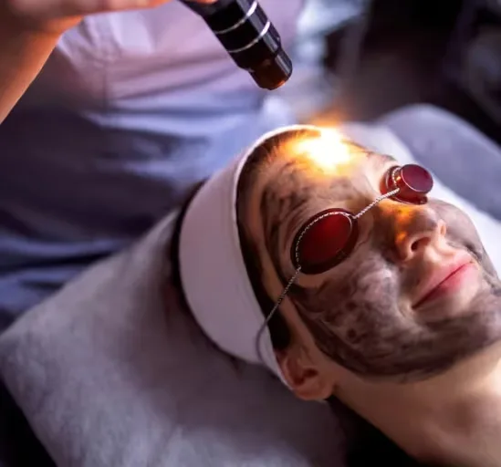 Laser Carbon Facial Done by an expert dermatologist