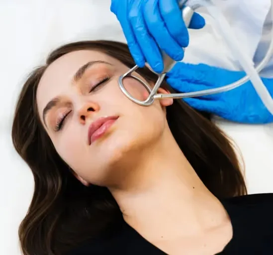 CO2 Laser Treatment performed by the dermatologist on women