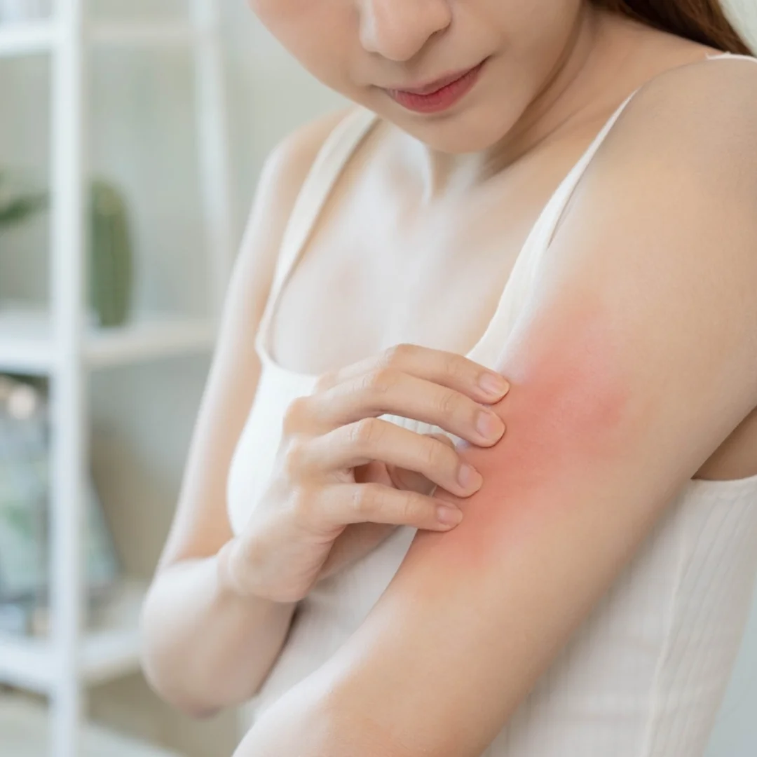 Autoimmune Skin Diseases on hand