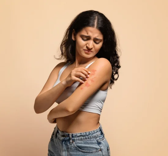 A Girl is suffering from dermatitis