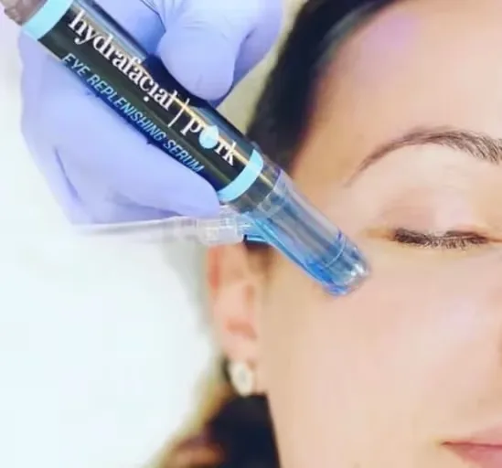 HydraFacial PERK Eye Treatment performed on women's face