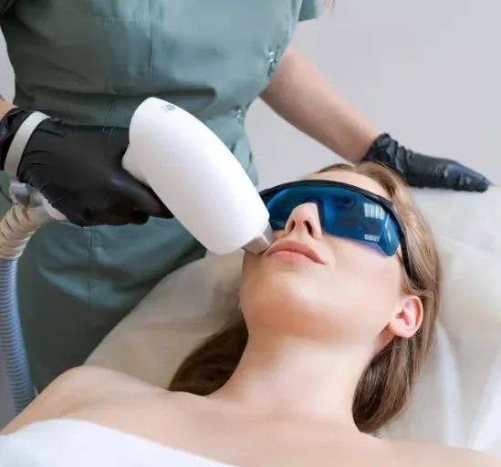 Women Face laser hair removal treatment is performed