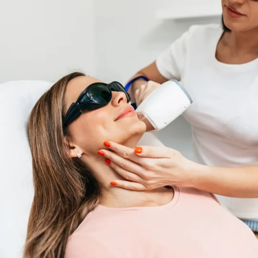 Women's Laser Face Hair Removal treatment by a dermatologist