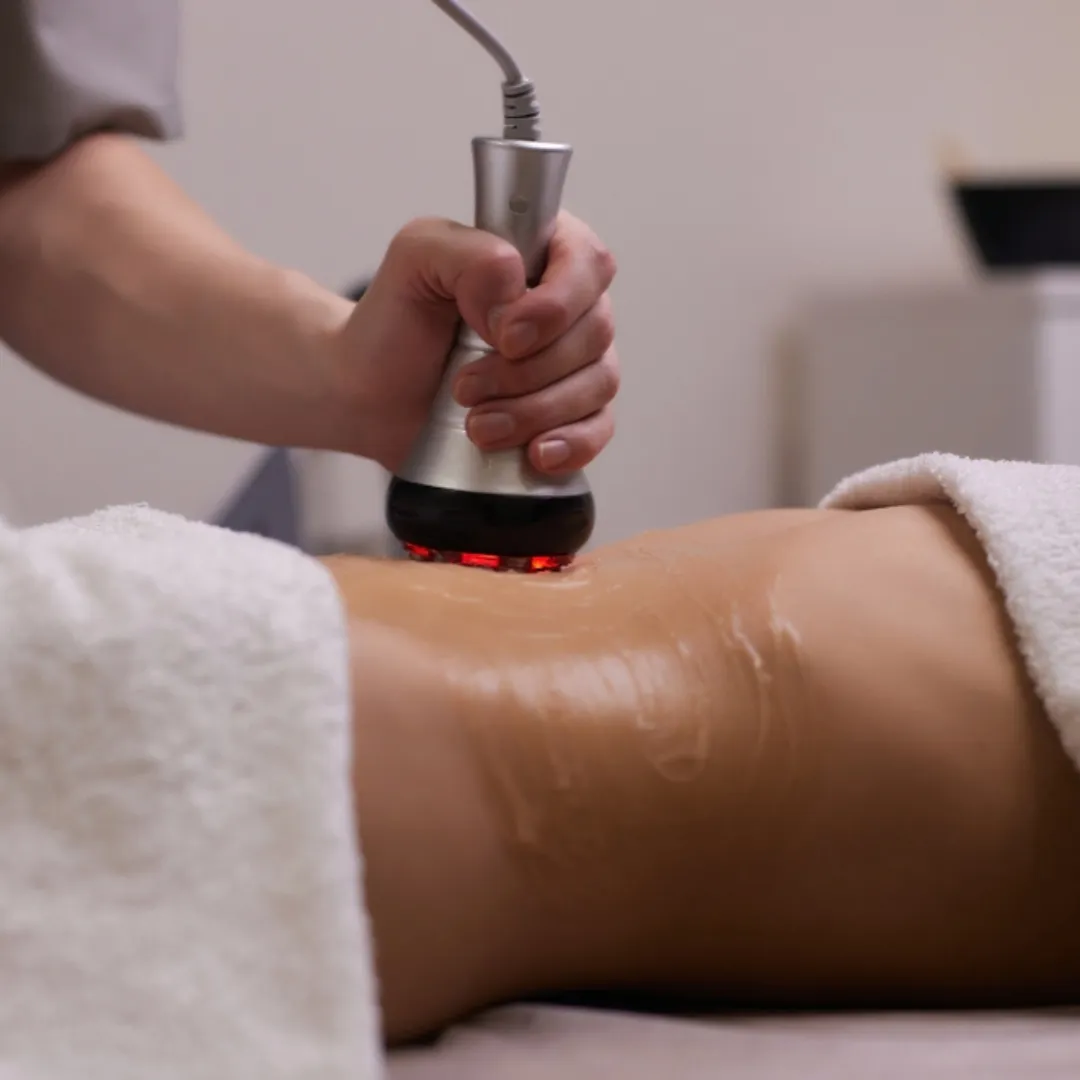 Aftercare and Results - Forma RF Treatment