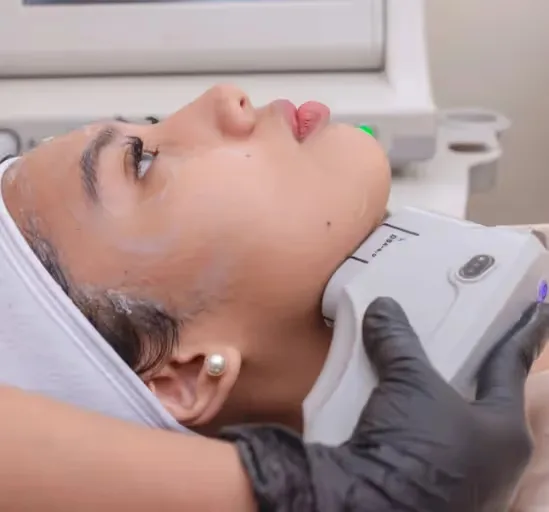 Non-surgical facelift HIFU treatment done by Dermatologist