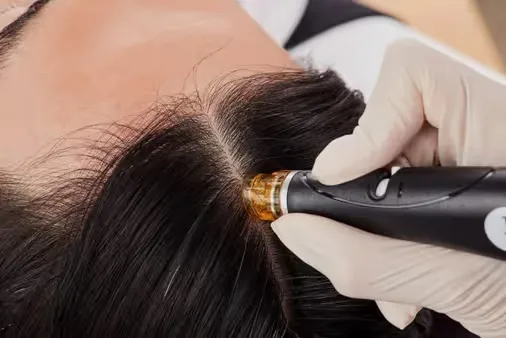 HydraFacial Keravive Treatment performed by dermatologists