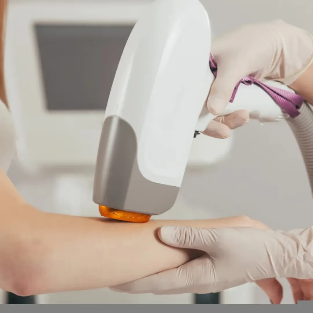 Laser Hair Removal Performed by the dermatologist