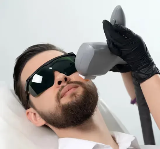 Men Laser Hair Removal treatment is performed by a dermatologist.