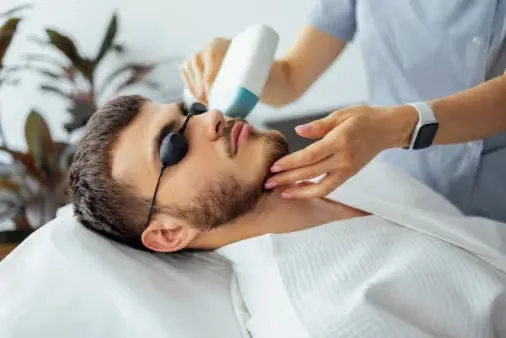 beard shaping laser hair removal treatment is performed