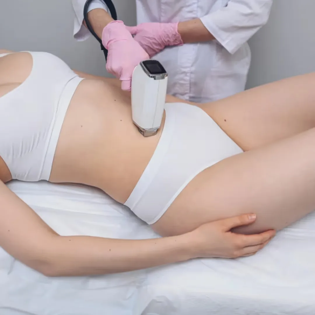 A dermatologist performs laser hair removal for stomach