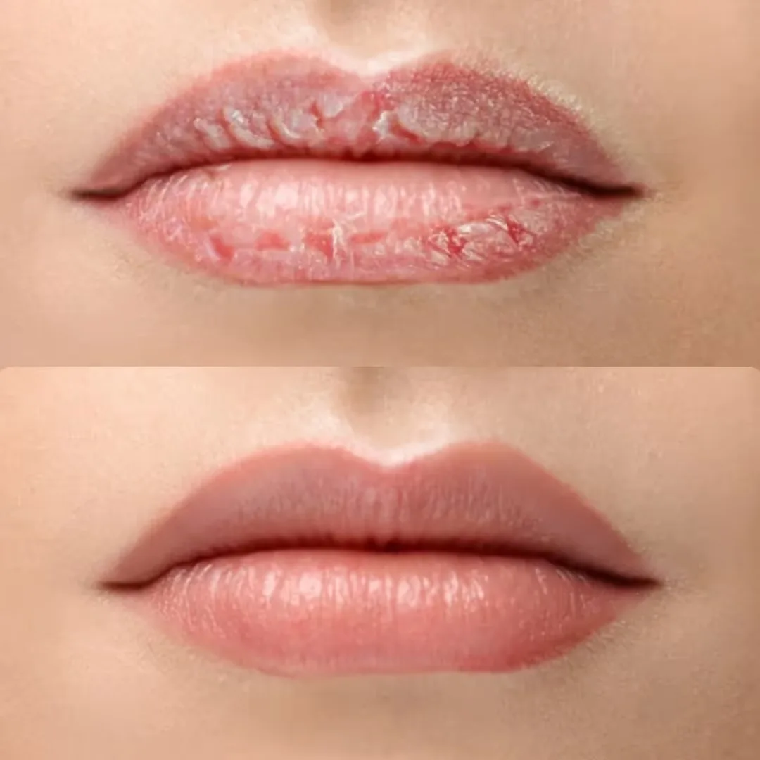 Lips shed the dead skin cells and reveal the new skin