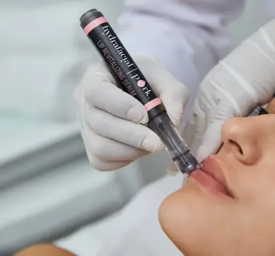 Ultimate Lip Treatment at UNCOVER Clinics