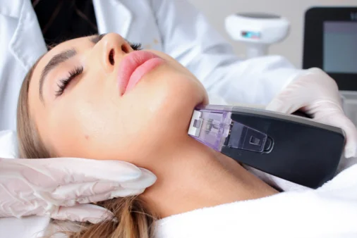 Morpheus8 Microneedling performed by a dermatologist