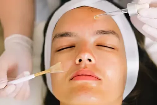 A dermatologist performs Party Peel therapy