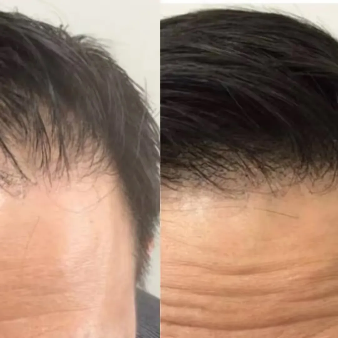 Before and after QR 678 Hair Treatment results