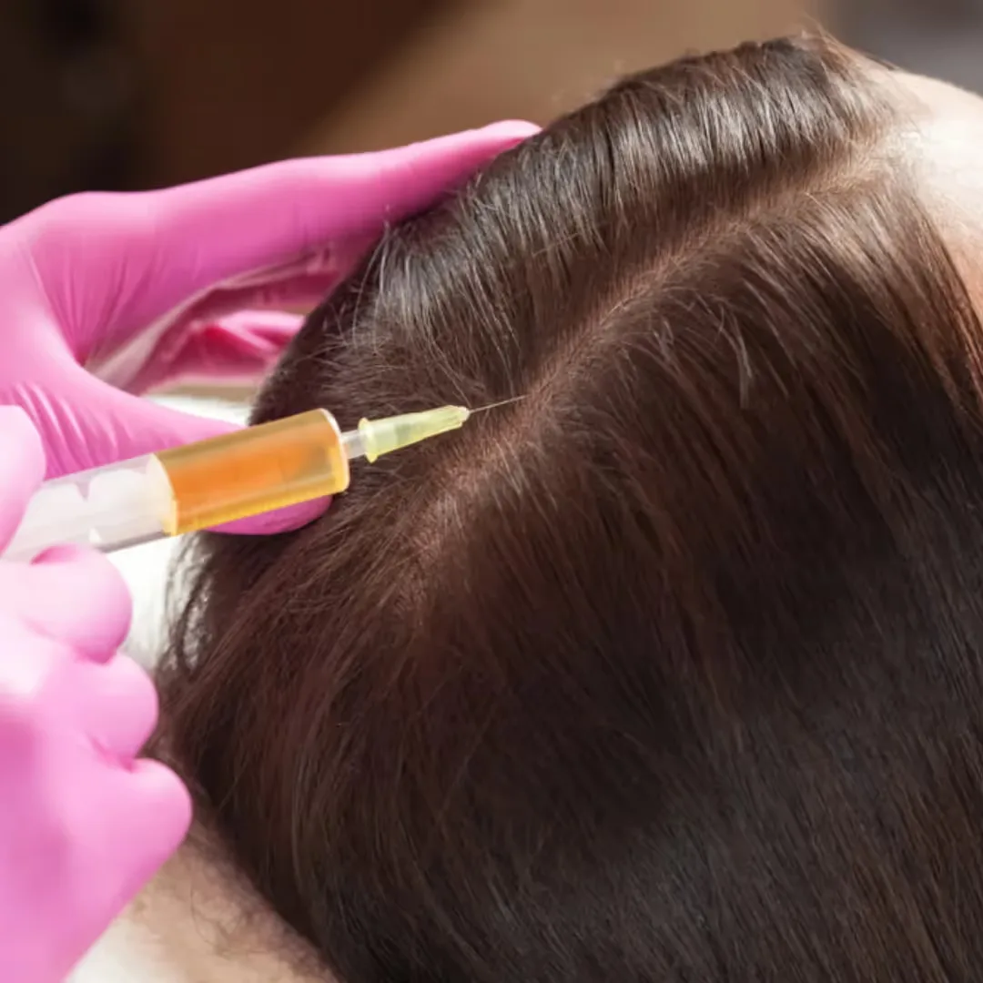 QR 678 treatment performed by a Dermatologist
