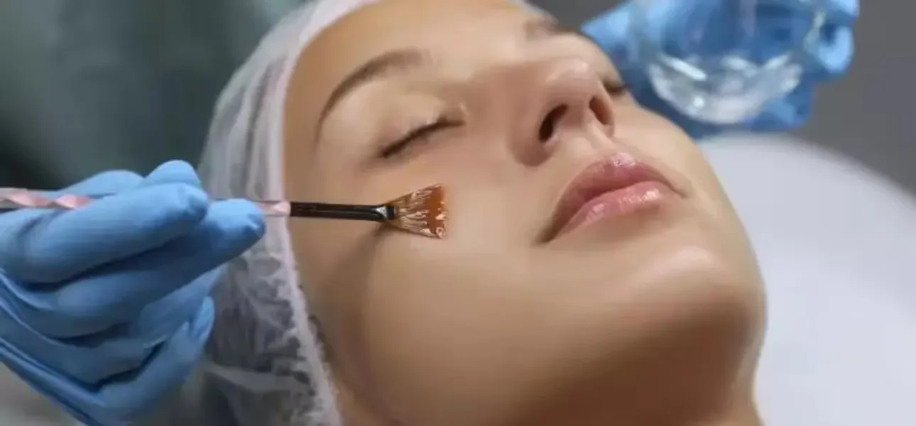 A dermatologist performs UnTint Under eye peel