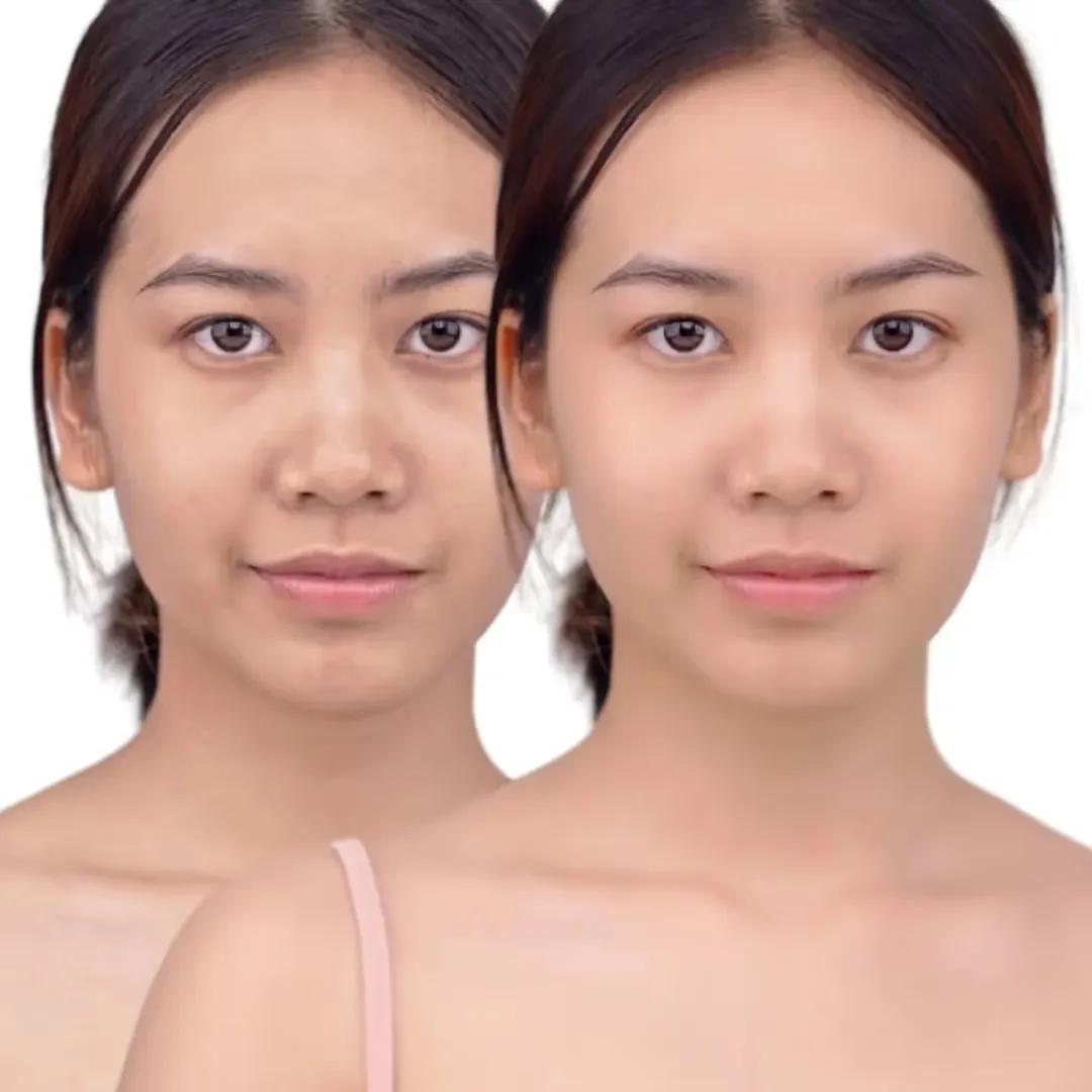 Before and after UnTan Glow Peel results image