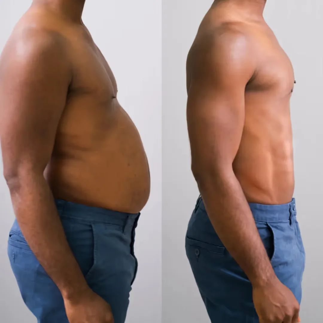 Before and after results of weight management program