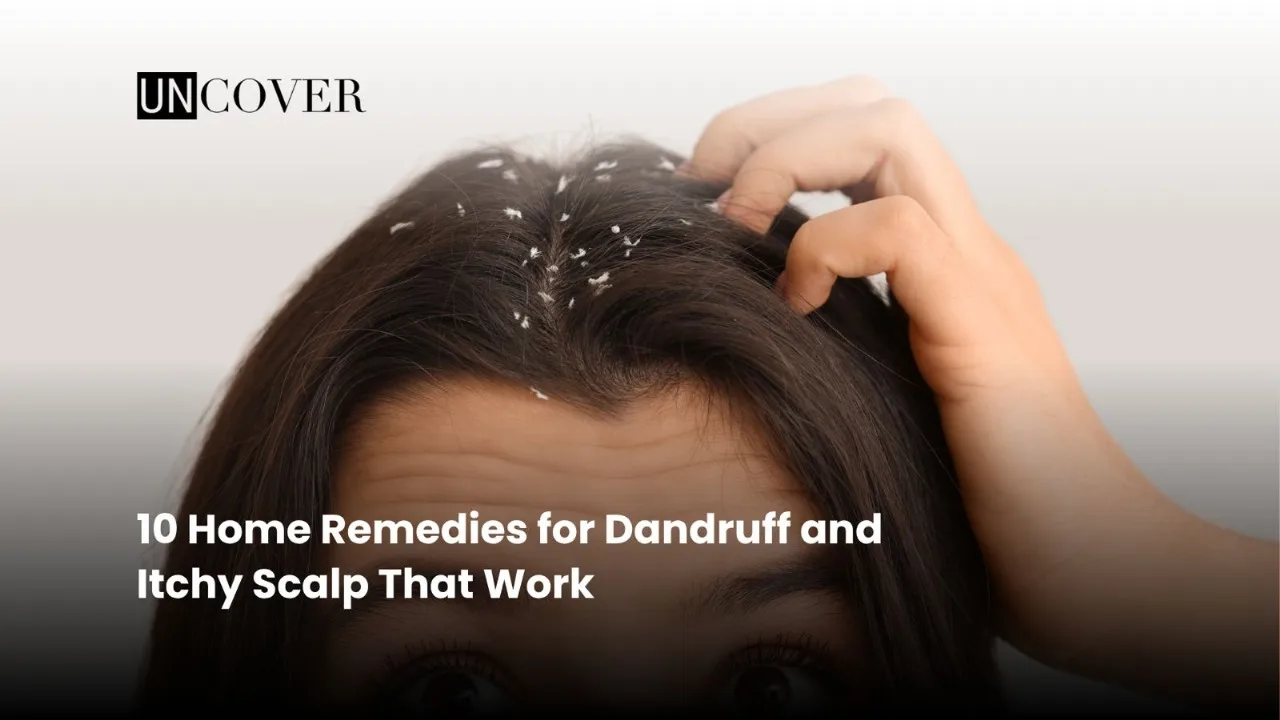 Featured image: 10 Home Remedies for Dandruff and Itchy Scalp That Work