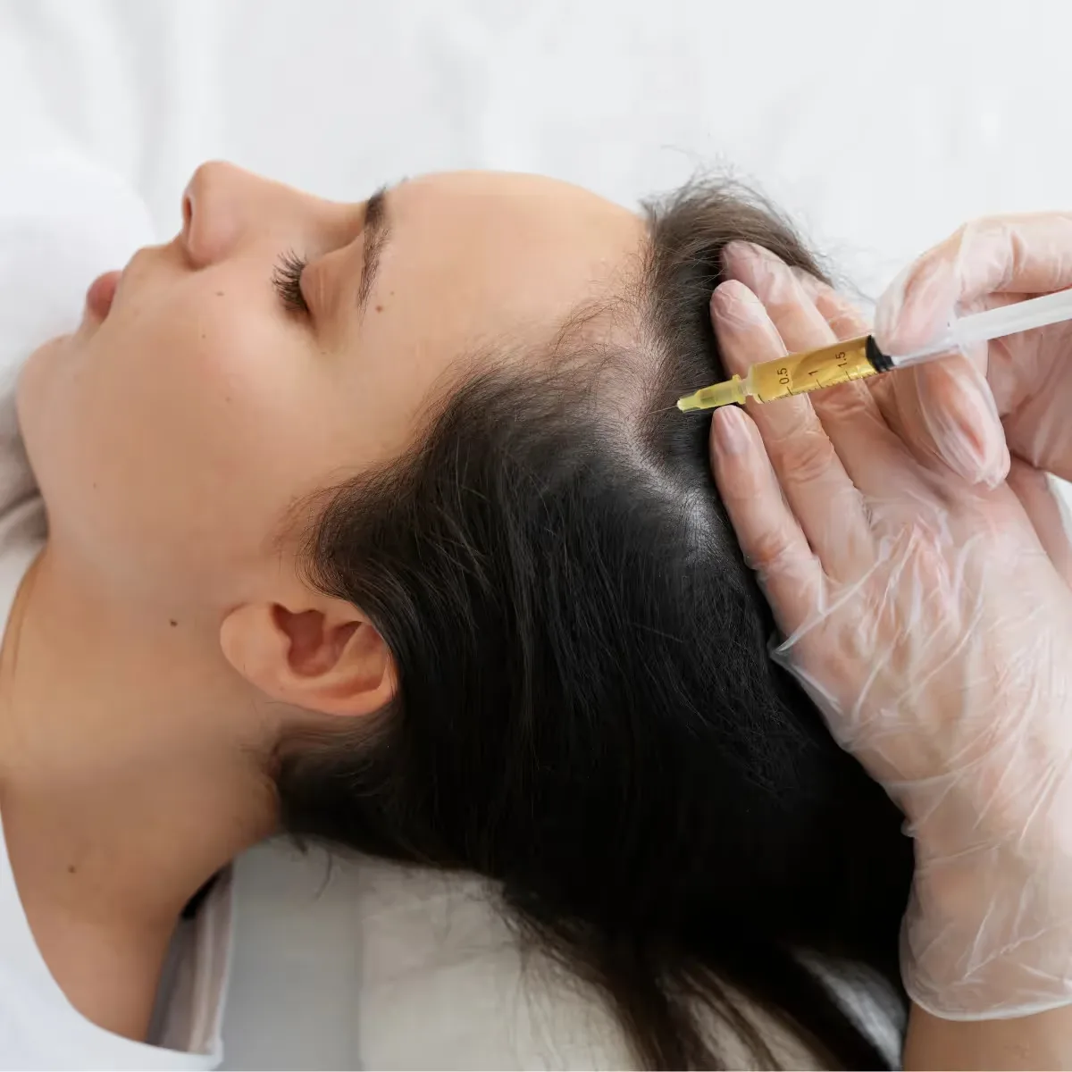 Featured image: Alopecia and Hair Loss: Causes and Treatment