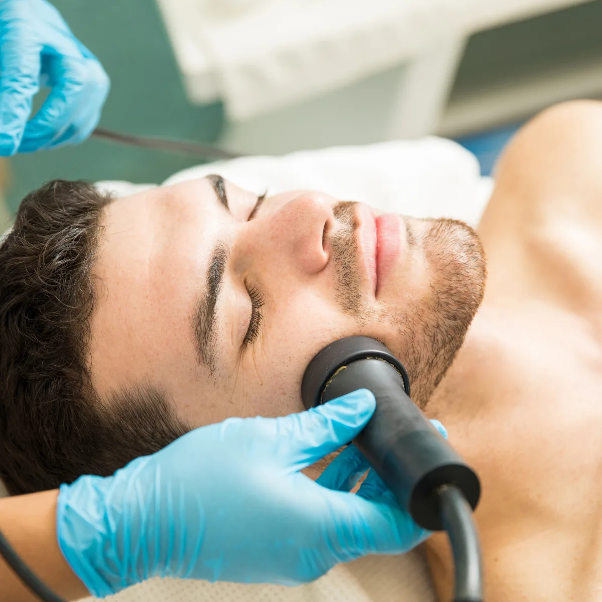 Featured image: Can laser hair removal sculpt my beard?