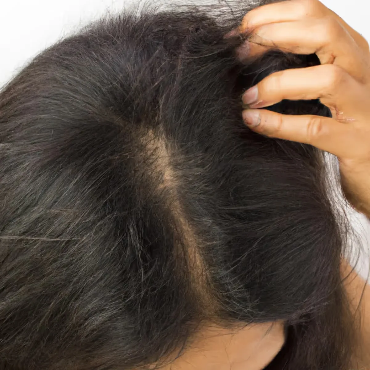 Featured image: Home Remedies for Hair Fall