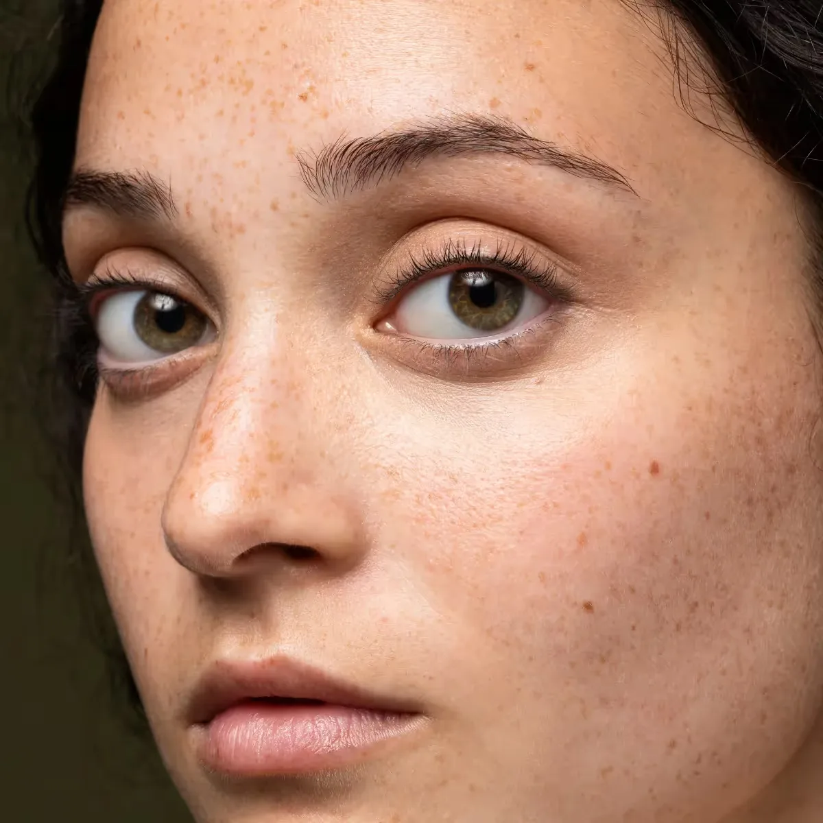 Featured image: How Much Does Scar Removal Cost in India? (A Friendly Guide)