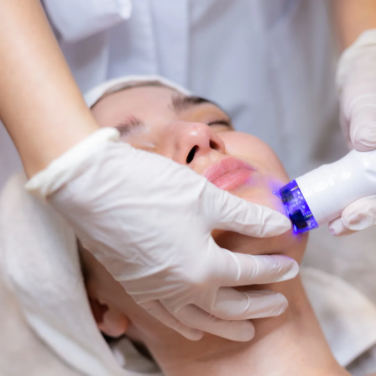 Featured image: Laser Skin Resurfacing: Cost, Treatment, Procedure &amp; Results