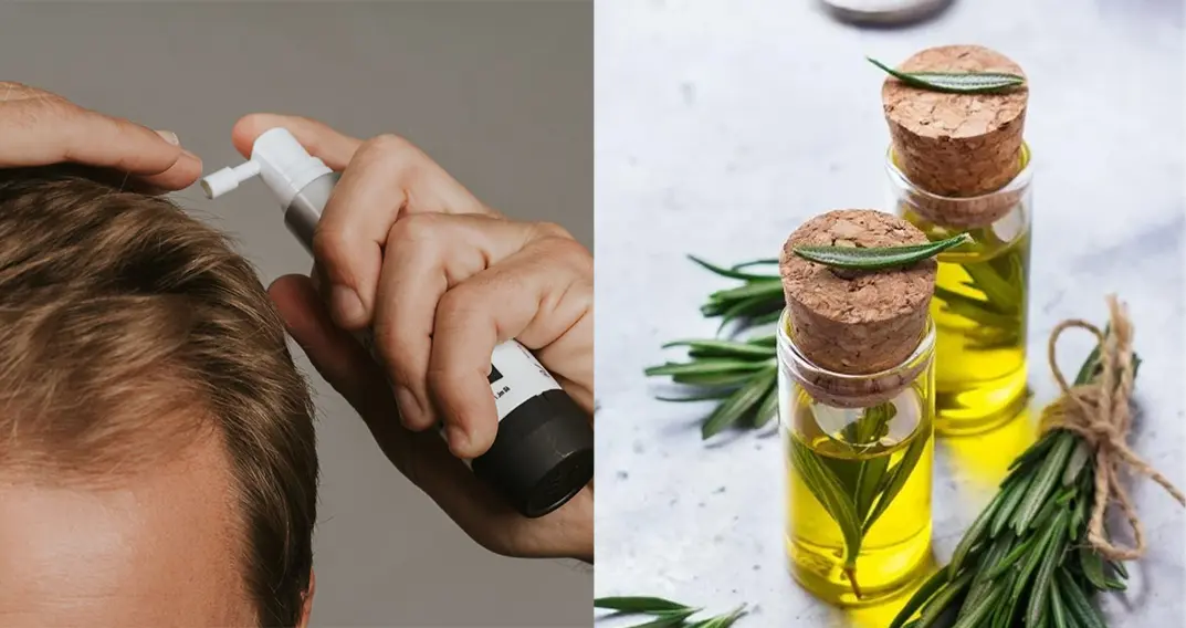 Featured image: Rosemary Oil vs Minoxidil: Can a Kitchen Ingredient Really Regrow Hair?