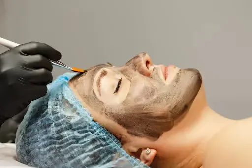 Featured image: The Science Behind Carbon Peel Facials: Rejuvenating Skin with Laser Treatment