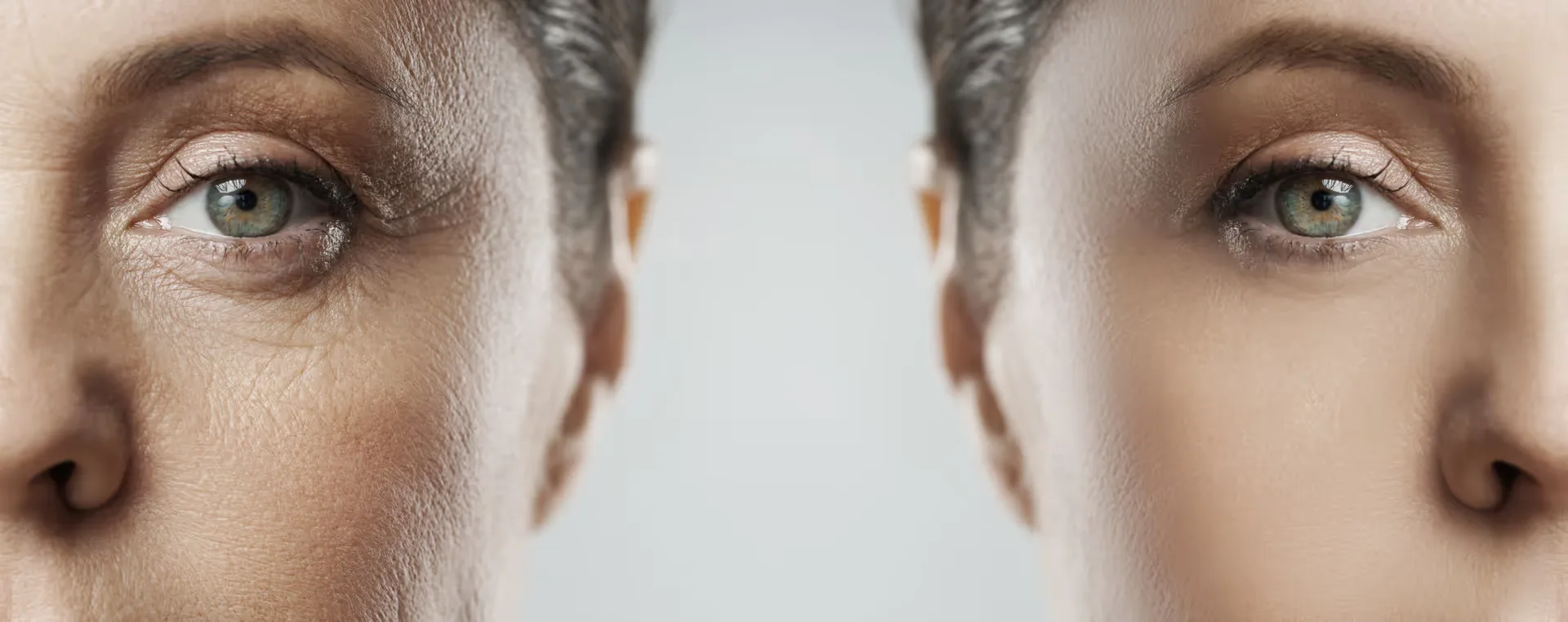 Featured image: Transforming Faces: Ex-pert Strategies for Combating Signs of Aging