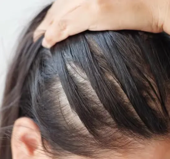 Header image: Hair Loss & Thinning 