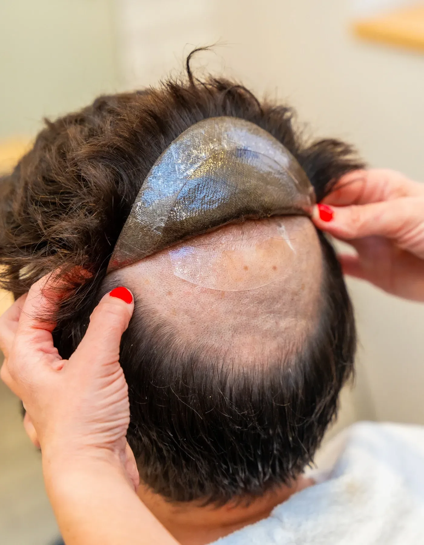 hair patch 