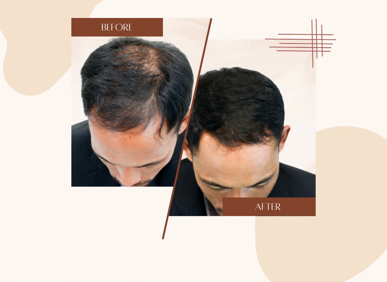 Visible Results
In Just 3 Sessions