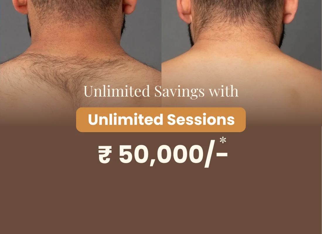 Permanent Laser Hair Removal 